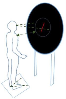 Comparison of Clinical Balance and Visual Dependence Tests in Patients With Chronic Dizziness With and Without Persistent Postural-Perceptual Dizziness: A Cross-Sectional Study